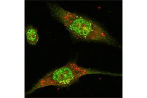Confocal immunofluorescence analysis of Eca-109 cells using ERK2 mouse mAb (green).