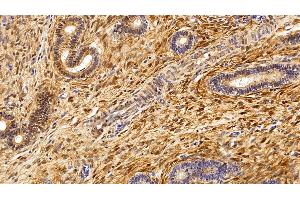 Detection of S100A6 in Porcine Uterus Tissue using Polyclonal Antibody to S100 Calcium Binding Protein A6 (S100A6)