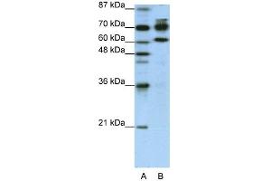WB Suggested Anti-ADARB1 Antibody Titration:  1. (RED1 anticorps  (N-Term))