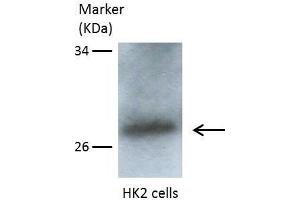 WB Image Sample(30 μg of whole cell lysate) A:293T B:A431, C:H1299 10% SDS PAGE antibody diluted at 1:1500