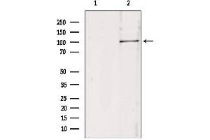Western blot analysis of extracts from 293, using RBM15 antibody. (RBM15 anticorps  (N-Term))