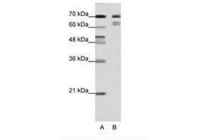 Image no. 1 for anti-Transcription Factor 3 (E2A Immunoglobulin Enhancer Binding Factors E12/E47) (TCF3) (N-Term) antibody (ABIN202854) (TCF3 anticorps  (N-Term))