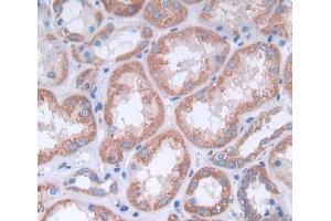 Used in DAB staining on fromalin fixed paraffin- embedded kidney tissue