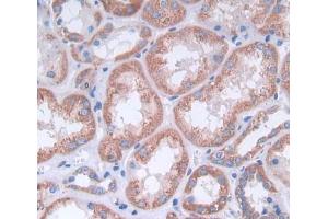 Used in DAB staining on fromalin fixed paraffin- embedded kidney tissue (alpha Adducin anticorps  (AA 99-328))