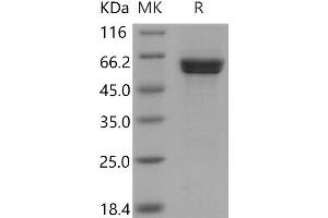 Western Blotting (WB) image for Calcium/calmodulin-Dependent Protein Kinase ID (CAMK1D) (Active) protein (GST tag) (ABIN7317091)