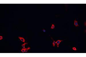 ABIN6266477 staining C1C12 cells by IF/ICC. (BAX anticorps  (Internal Region))