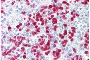Human Spleen, Neutrophils (formalin-fixed, paraffin-embedded) stained with S100A8 antibody ABIN214203 at 2. (S100A8 anticorps)