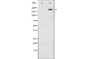 Western blot analysis of Tuberin/TSC2 expression in 293 whole cell lysates,The lane on the left is treated with the antigen-specific peptide. (Tuberin anticorps  (Internal Region))
