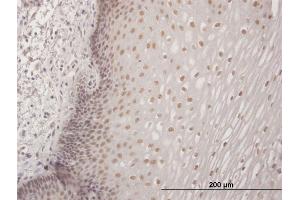 Immunoperoxidase of purified MaxPab antibody to CBFA2T3 on formalin-fixed paraffin-embedded human esophagus.