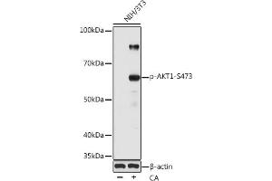 Western blot analysis of extracts of various cell lines, using Phospho--S473 pAb (ABIN1513328, ABIN5664973, ABIN5664975 and ABIN6225474) at 1:1000 dilution. (AKT1 anticorps  (pSer473))
