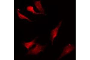 ABIN6275200 staining HepG2 by IF/ICC.