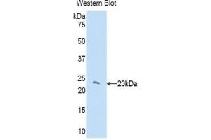 Detection of recombinant CBX3 using Polyclonal Antibody to Chromobox Homolog 3 (CBX3) (CBX3 anticorps  (AA 1-183))