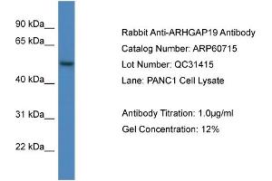 Western Blotting (WB) image for anti-rho GTPase Activating Protein 19 (ARHGAP19) (C-Term) antibody (ABIN2788550) (ARHGAP19 anticorps  (C-Term))