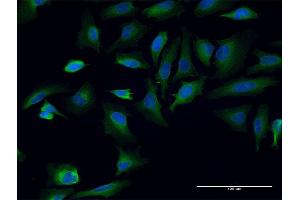 Immunofluorescence of monoclonal antibody to TPR on HeLa cell. (TPR anticorps  (AA 1-98))