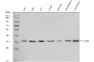 Western blot analysis of AIDA using anti-AIDA antibody (ABIN7601996).