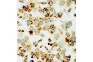 Anti-MTCO1 antibody,  ICC ICC: HEPA Cell