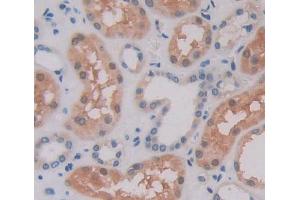 Used in DAB staining on fromalin fixed paraffin- embedded Kidney tissue (POMP anticorps  (AA 1-141))