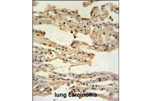 anti-Interferon Induced Transmembrane Protein 2 (IFITM2) (AA 1-30), (N-Term) antibody