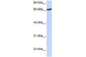 WB Suggested Anti-L3MBTL Antibody Titration:  0. (L3MBTL1 anticorps  (N-Term))