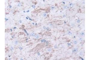 IHC-P analysis of Mouse Cerebrum Tissue, with DAB staining. (METRN anticorps  (AA 22-291))