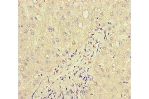 Immunohistochemistry of paraffin-embedded human liver tissue using ABIN7157839 at dilution of 1:100