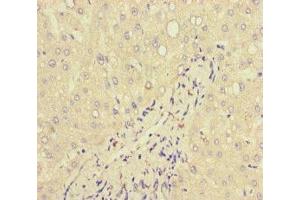 Immunohistochemistry of paraffin-embedded human liver tissue using ABIN7157839 at dilution of 1:100 (Lactoferrin anticorps  (AA 156-413))