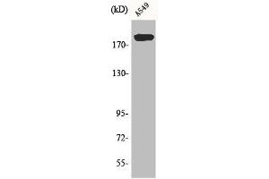 Western Blot analysis of A549 cells using BIG2 Polyclonal Antibody