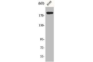 Western Blot analysis of A549 cells using BIG2 Polyclonal Antibody (ARFGEF2 anticorps  (C-Term))