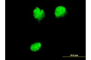 Immunofluorescence of monoclonal antibody to NUP62 on HeLa cell. (NUP62 anticorps  (AA 423-522))