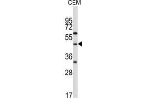 Western Blotting (WB) image for anti-Cbl proto-oncogene C (CBLC) antibody (ABIN2996831) (CBLC anticorps)
