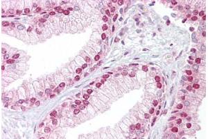 Anti-TCEA1 antibody IHC staining of human prostate. (TCEA1 anticorps  (AA 71-120))