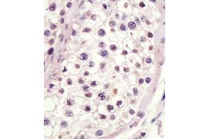 staining MLL3 in human testis tissue sections by Immunohistochemistry (IHC-P - paraformaldehyde-fixed, paraffin-embedded sections). (MLL3 anticorps  (C-Term))