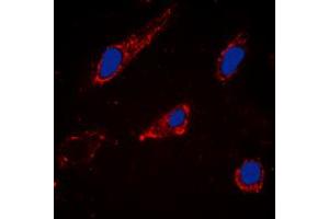 Immunofluorescent analysis of Cytochrome P450 2C19 staining in Hela cells. (CYP2C19 anticorps  (Center))