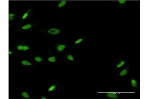 Immunofluorescence of monoclonal antibody to LHX6 on HeLa cell.