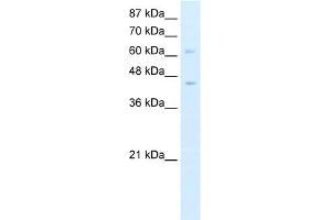WB Suggested Anti-ZBTB3 Antibody Titration:  0. (ZBTB3 anticorps  (N-Term))