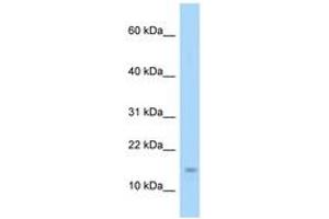 Image no. 1 for anti-Eukaryotic Translation Initiation Factor 4E Binding Protein 1 (EIF4EBP1) (AA 21-70) antibody (ABIN6748271)