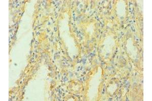 Immunohistochemistry of paraffin-embedded human kidney tissue using ABIN7159700 at dilution of 1:100 (MCPH1 anticorps  (AA 536-835))