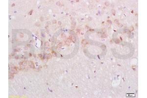 Formalin-fixed and paraffin embedded rat brain labeled with Anti-NGFR/p75NTR Polyclonal Antibody, Unconjugated (ABIN725660) at 1:200 followed by conjugation to the secondary antibody and DAB staining