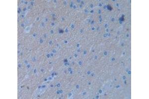 IHC-P analysis of Human Tissue, with DAB staining. (FGF3 anticorps  (AA 154-232))
