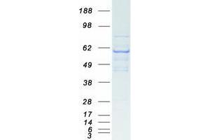 Validation with Western Blot