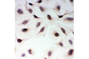 IHC analysis of MAD1 using anti-MAD1 antibody (ABIN3043387). (MAD1L1 anticorps  (AA 362-632))