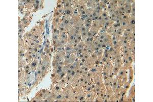 IHC-P analysis of liver tissue, with DAB staining. (ADCY7 anticorps  (AA 806-1052))