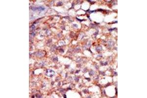 Image no. 2 for anti-Receptor-Interacting Serine-threonine Kinase 4 (RIPK4) (C-Term) antibody (ABIN360126) (RIPK4 anticorps  (C-Term))
