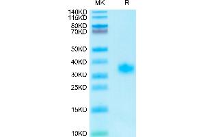 Human Adiponectin on Tris-Bis PAGE under reduced condition. (ADIPOQ Protein (AA 19-244) (His tag))