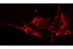 ABIN6275048 staining HuvEc cells by IF/ICC. (GBA3 anticorps  (Internal Region))