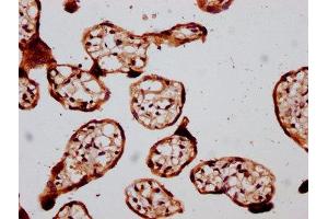 IHC image of ABIN7172786 diluted at 1:400 and staining in paraffin-embedded human placenta tissue performed on a Leica BondTM system. (GATAD2B anticorps  (AA 58-146))