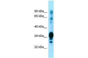 Western Blotting (WB) image for anti-Glycoprotein M6A (GPM6A) (C-Term) antibody (ABIN2790022) (GPM6A anticorps  (C-Term))