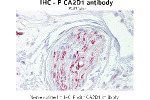 Image no. 1 for anti-Calcium Channel, Voltage-Dependent, alpha 2/delta Subunit 1 (CACNA2D1) (N-Term) antibody (ABIN347205) (CACNA2D1 anticorps  (N-Term))