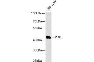 Western blot analysis of extracts of SH-SY5Y cells using PDK3 Polyclonal Antibody at dilution of 1:1000. (PDK3 anticorps)