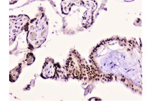 IHC analysis of Rad51 using anti-Rad51 antibody (ABIN6719396). (RAD51 anticorps)